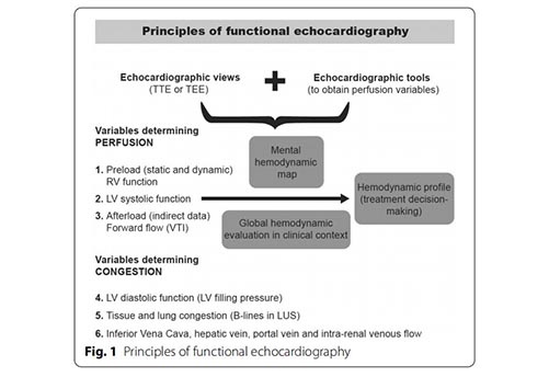 A simple algorithm for diferential  diagnosis in hemodynamic shock based on left  ventricle outfow tract velocity–time integral  measurement: a case series