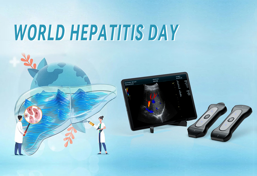 Observe World Hepatitis Day with Periodmed