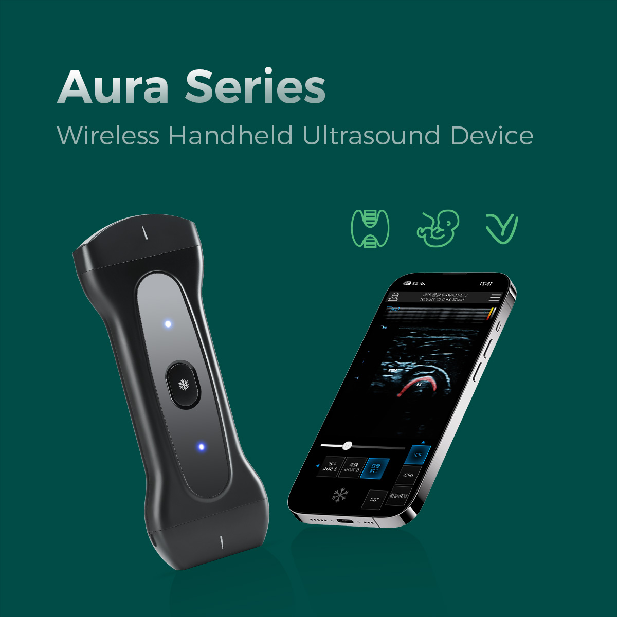 Wireless Handheld Ultrasound System