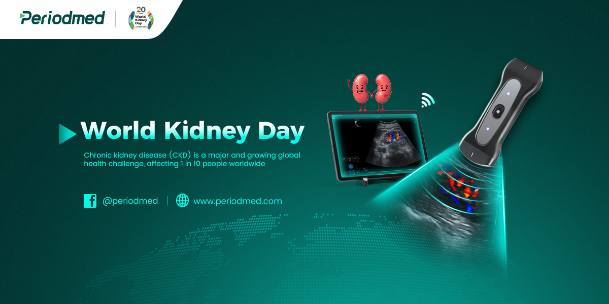 lQDPJwh55yQBt8HNAljNBLCwtzg5xOPC0o0Jiu_1In7lAA_1200_600