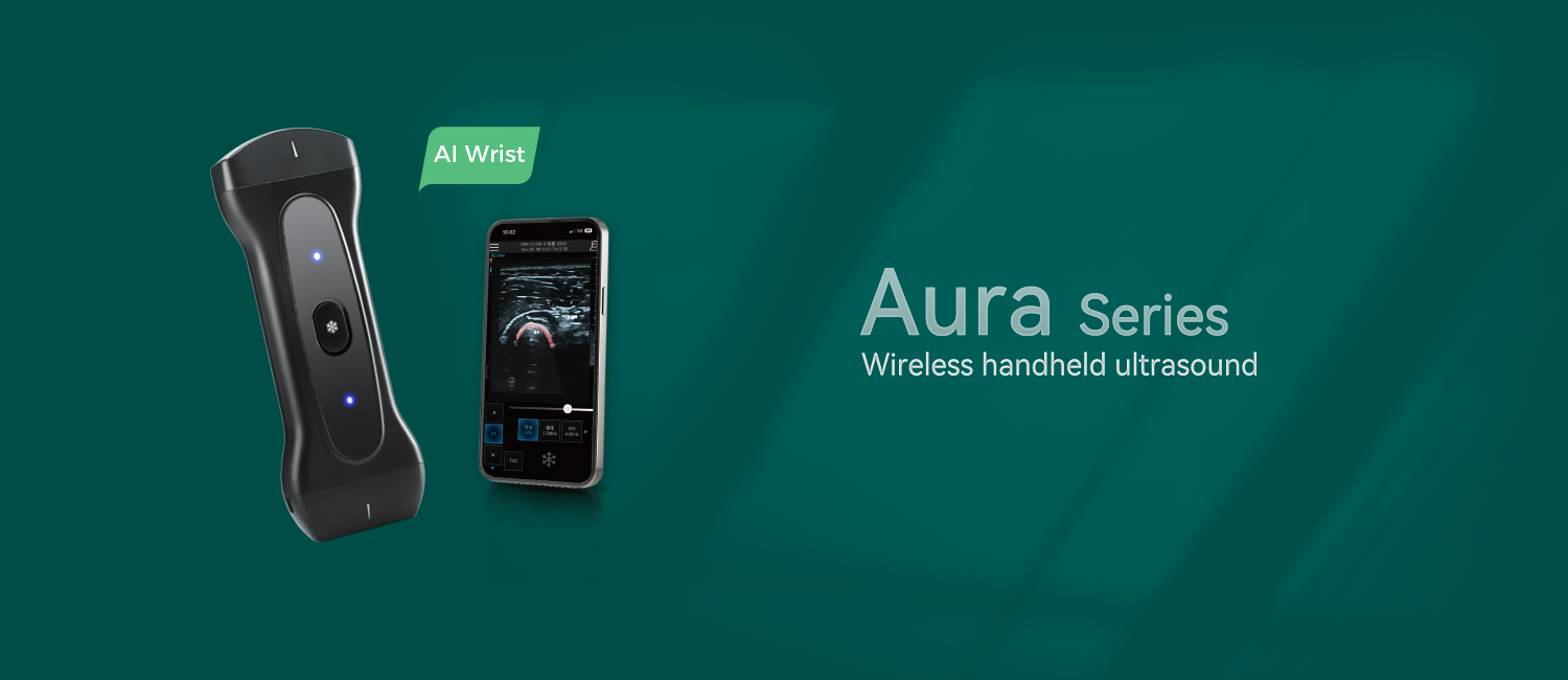 Wrist AI