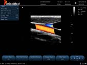  Linear Probe-Color Mode-Carotid2