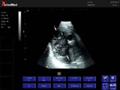  Convex Probe-B Mode- Right Kidney Horse