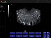  Trans-vaginal Probe-B Mode-Uterus Cow