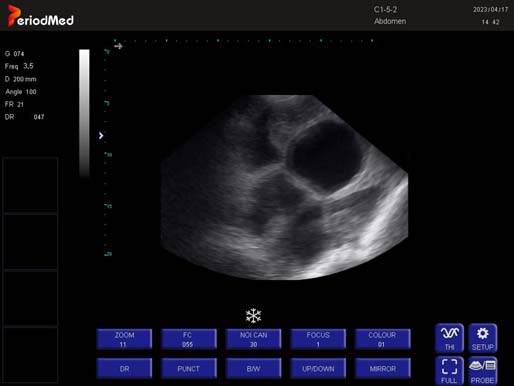  Convex Probe-B Mode-Uterus1 Pig