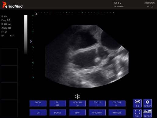  Convex Probe-B Mode-Uterus2 Pig