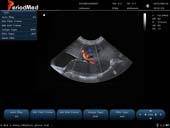   Micro-convex Probe-Color Doppler Mode-Liver Cat
