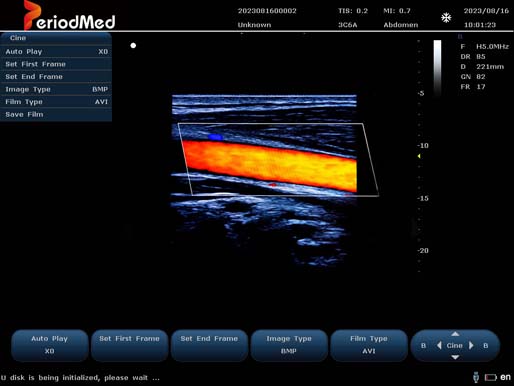  Linear Probe-Color Mode-Carotid1