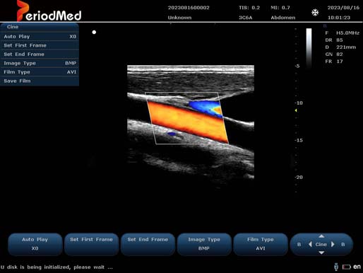  Linear Probe-Color Mode-Carotid2
