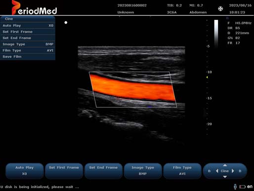  Linear Probe-Color Mode-Carotid3