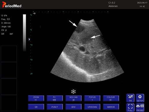 Convex Probe-B Mode- Right Liver  Horse1