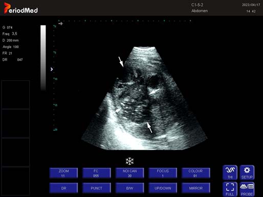 Convex Probe-B Mode- Right Kidney Horse