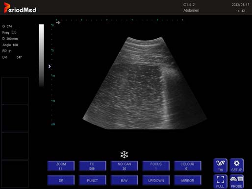 Convex Probe-B Mode- Stomach Horse