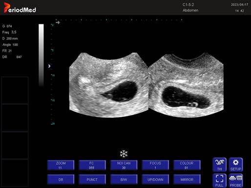 Trans-vaginal Probe-BB Mode-Uterus Cow