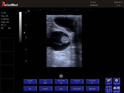 Linear Probe-B Mode- Pregnant  Cow1