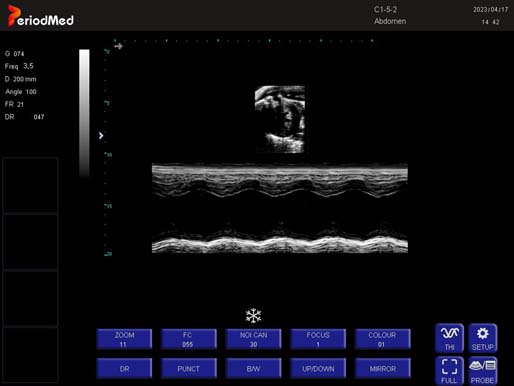 Micro-convex Probe-M Mode-Cardiac Mouse