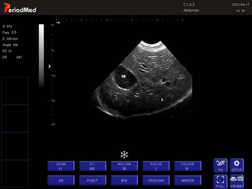 Convex Probe-B Mode-Liver and Gallbladder  Dog