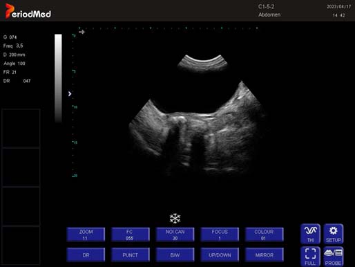 Convex Probe-B Mode-Bladder  Dog