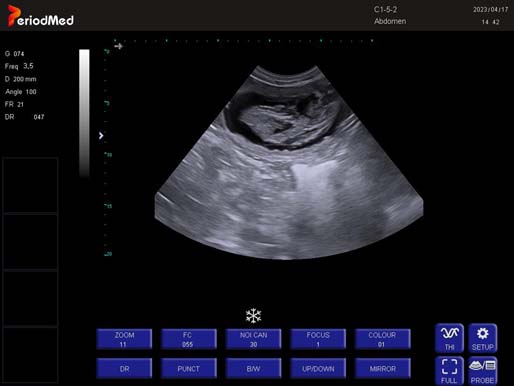 Convex Probe-B Mode-Pregnancy Dog