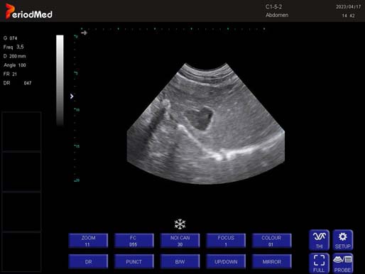 Convex Probe-B Mode-Liver Cat