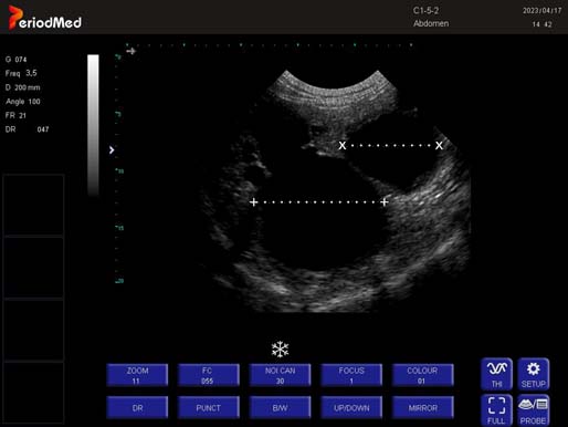 Convex Probe-B Mode-Bladder Cat