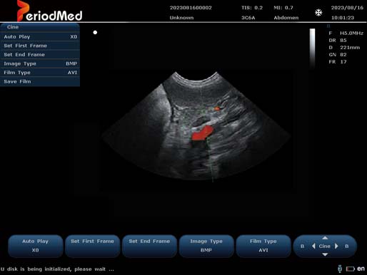 Micro-convex Probe-Color Doppler Mode-Spleen Dog