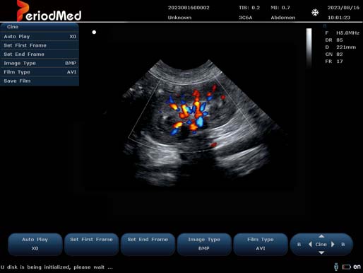 Micro-convex Probe-Color Doppler Mode-Kidney Dog
