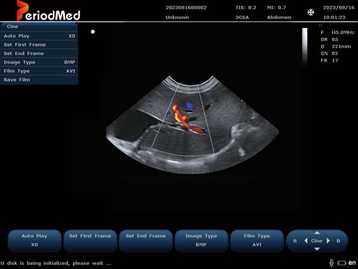  Micro-convex Probe-Color Doppler Mode-Liver Cat