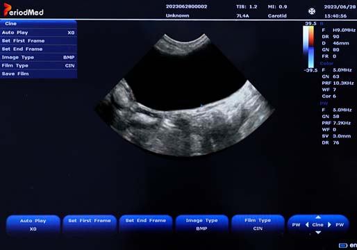 Micro-Convex Probe，B Mode，Bladder