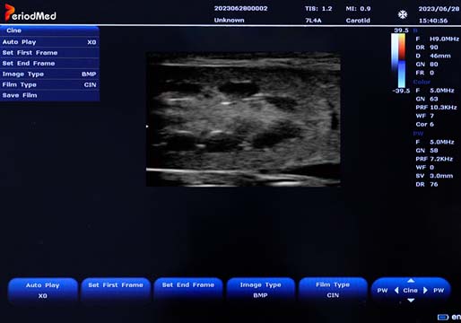 Micro-Convex Probe，B Mode，Kidney