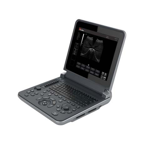 Laptop All-Digital Ultrasound Diagnostic System PMS-H12