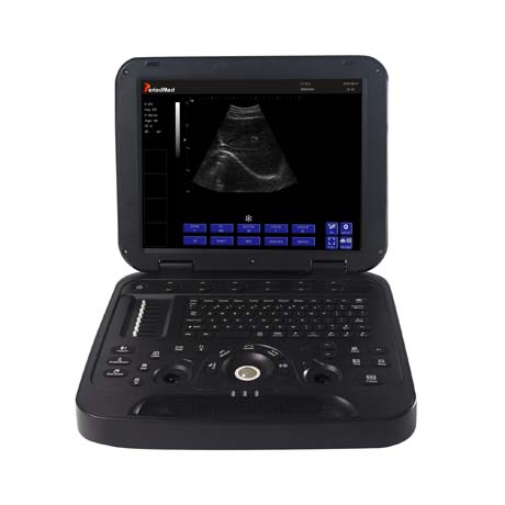 Laptop All-Digital Ultrasound Diagnostic System PMS-H15