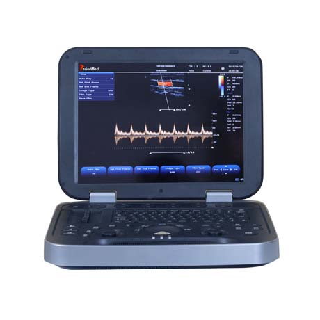 Fully digital Portable Color Doppler Ultrasound Machine PMS-HL8
