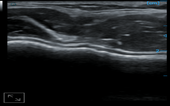 2025-04-16_100642