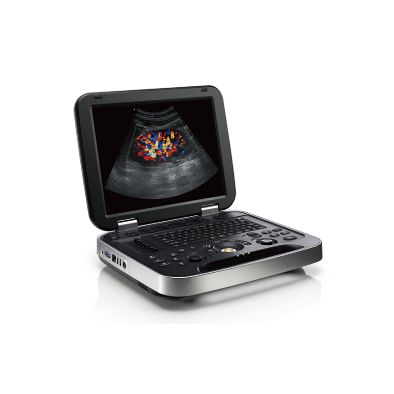 Portable Color Doppler Ultrasound System PU-L151A