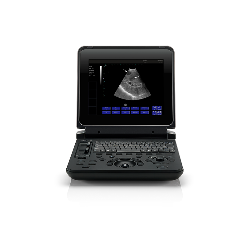 Digital Diagnostic Ultrasound System PU-DL121A