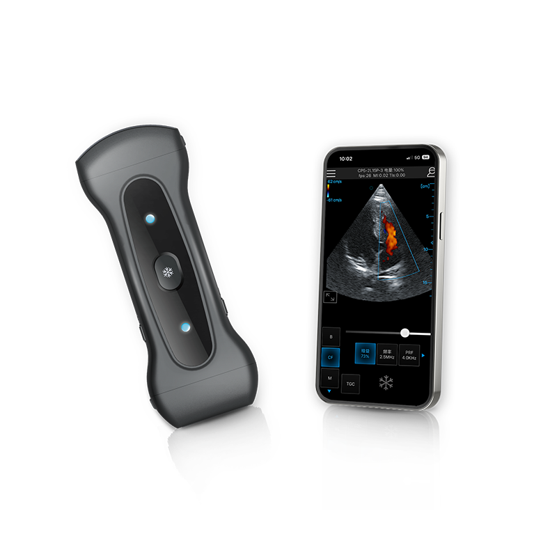 Aura Series Wireless&Handheld Color Ultrasound System
