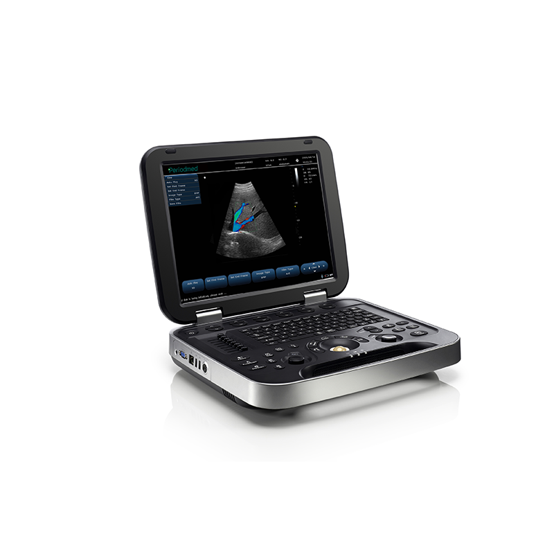 Portable Veterinary Ultrasound System PU-VL151B