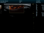 手指微血流模式Finger SMV Mode Imaging