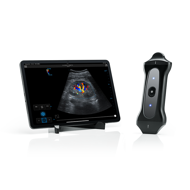 Wireless&Handheld Color Ultrasound System PIU2B