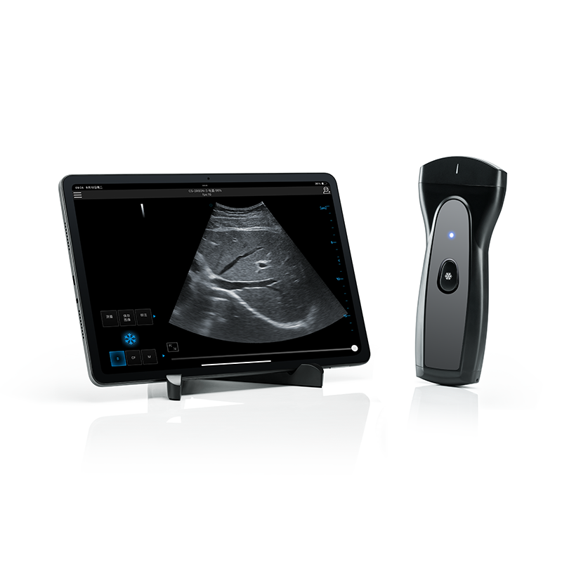 Wireless&Handheld Color Ultrasound System PIU1B