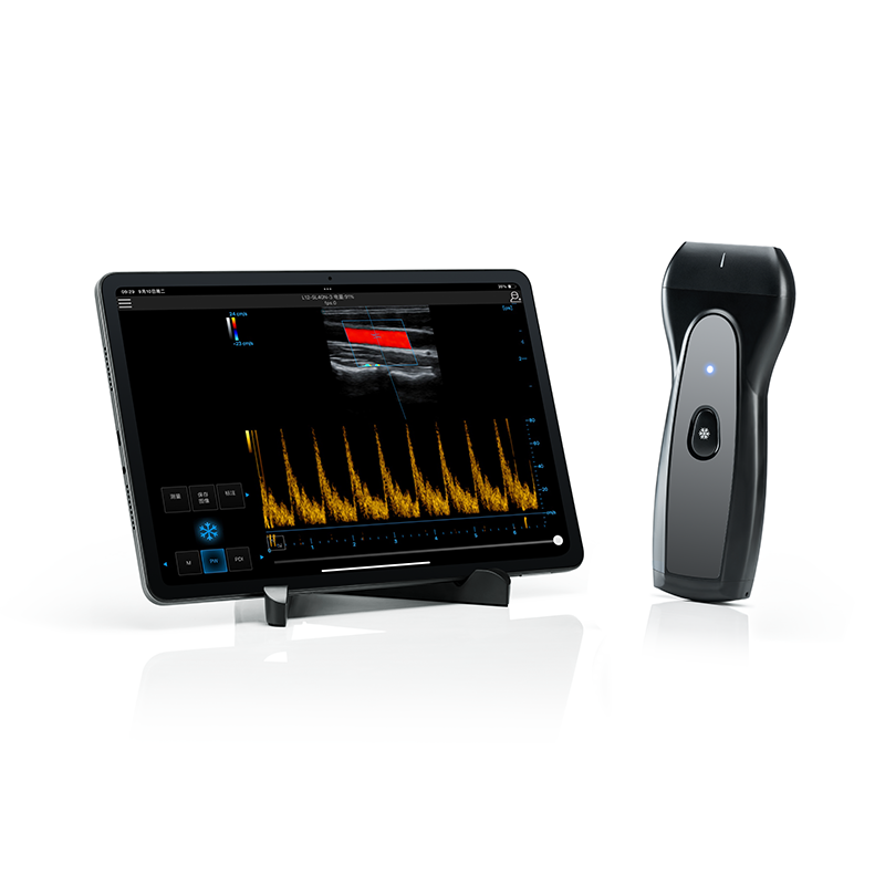 Wireless&Handheld Color Ultrasound System PIU1A