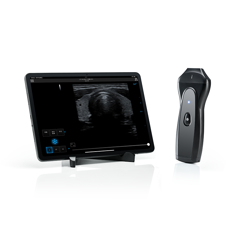 Wireless&Handheld Color Ultrasound System PIU1C