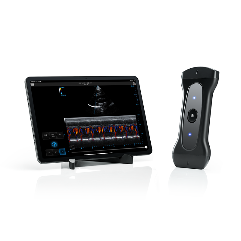 PIU2A Wireless Ultrasound System