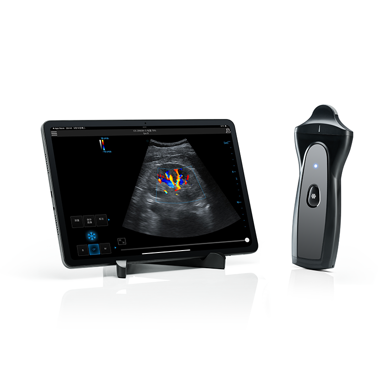 Wireless&Handheld Color Ultrasound System PIU1D