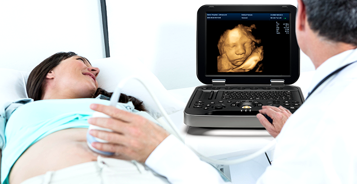 Abdominal Ultrasound