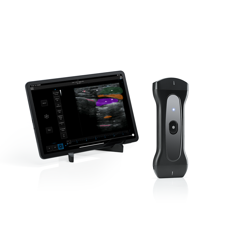 Digital Ultrasound Solution Powered by AI