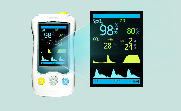 Vital Signs Monitor