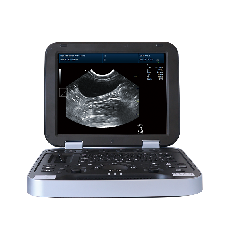 Portable Vet Ultrasound Machine for Pet Hospital PU-VDL153A