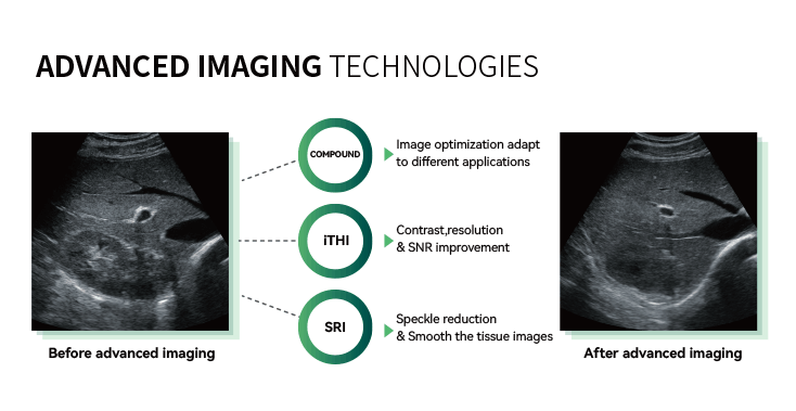 Revo T1 ultrasound imaging